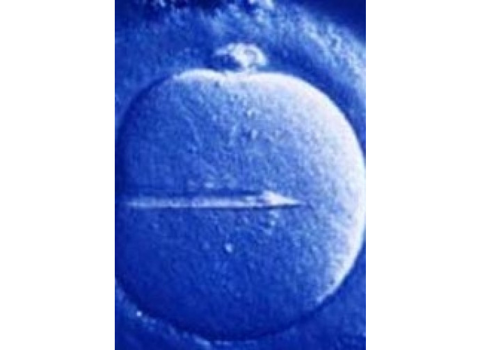 L'impianto di un embrione